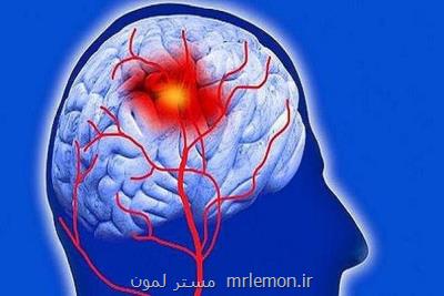 پنج راه اصلی جلوگیری از سكته مغزی را بشناسید