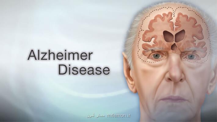 درمان آلزایمر ناشی از ضربه مغزی با داروی جدید