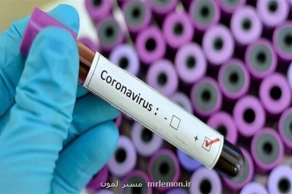 لیست جدید آزمایشگاه های تشخیصی كووید 19