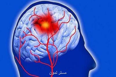 ریسک سکته مغزی در زنان جوان بیشتر است