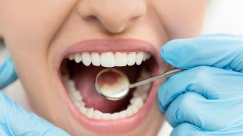 برخی مشکلات دندانی با بیماریهای دیگر مرتبط هستند