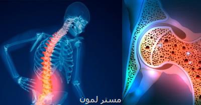 از بیماری خاموش پوکی استخوان چه می دانید؟