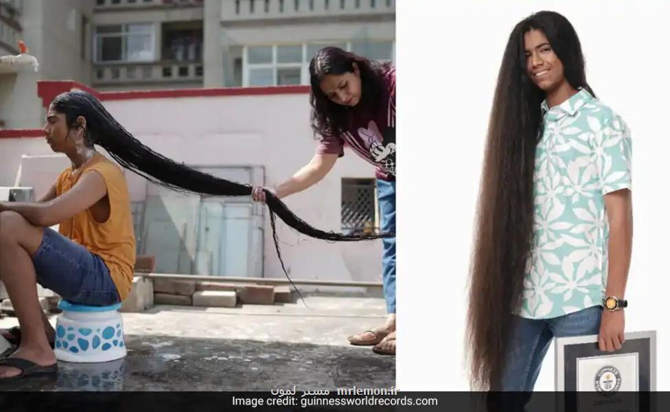 مو بلندترین پسر جهان، عکس