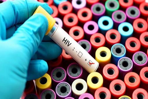 اخطار سازمان ملل در رابطه با افزایش مبتلایان به اچ آی وی