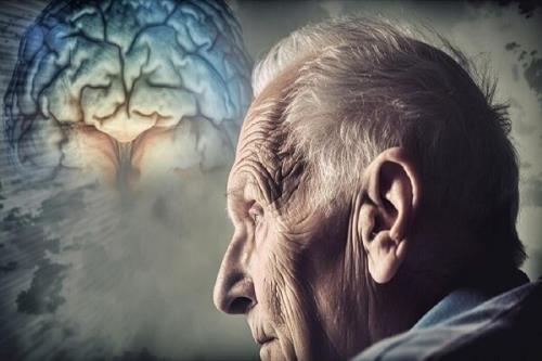 نتایج اعجاب انگیز یک پژوهش دارویی که از آلزایمر پیشگیری می کند