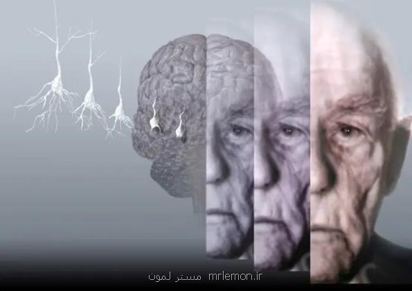 رمزگشایی از تفاوت های جنسیتی در مبتلا شدن به زوال عقل