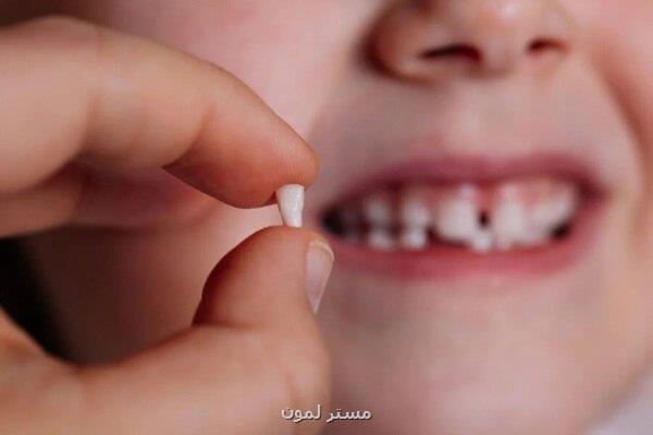 دندان شیری را جدی بگیرید