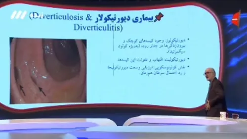 علت درد های شدید روده در بیمار به همراه فیلم