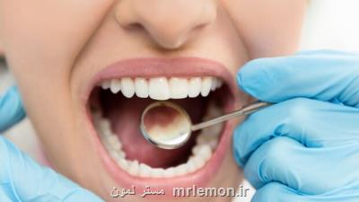 عمر مفید ایمپلنت های دندانی 10 سال است