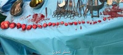 خارج كردن 27 توده از رحم دختر 39 ساله بندرعباسی