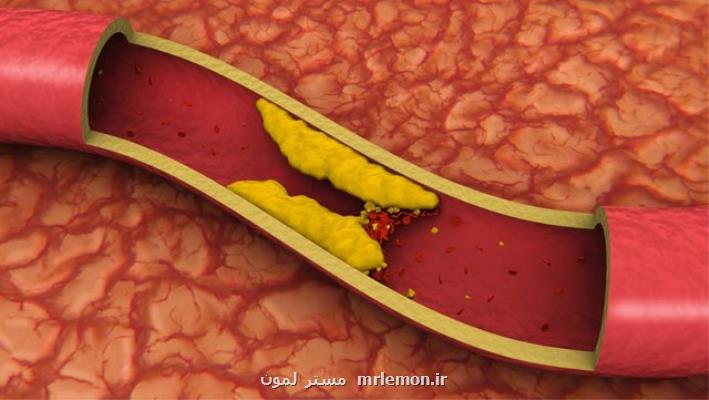 كلسترول را از ۲۵ سالگی كنترل كنید